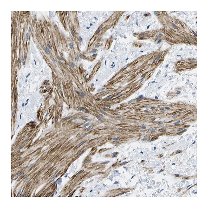 Atlas Antibodies Anti-ADGRG6 Antibody