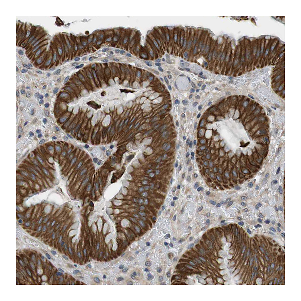 Atlas Antibodies Anti-ADGRL3 Antibody