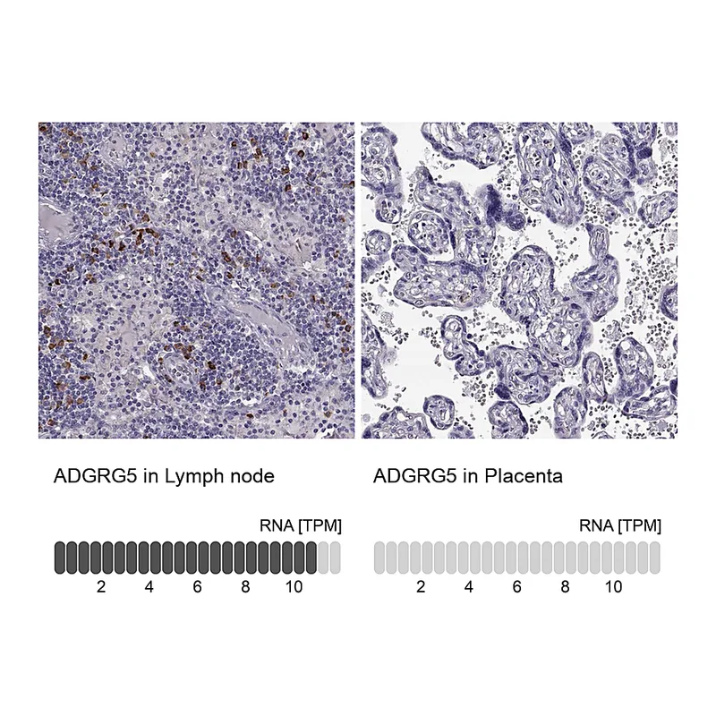 Atlas Antibodies Anti-ADGRG5 Antibody