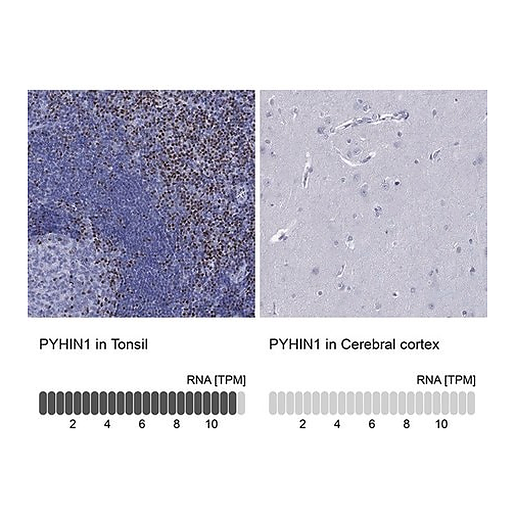 Merck Anti-PYHIN1 antibody produced in rabbit