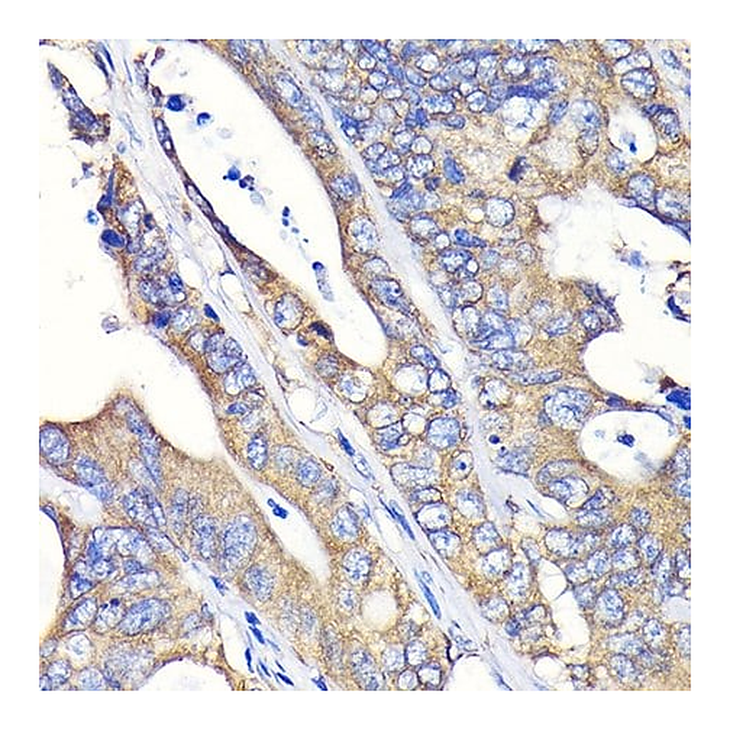 Merck Anti-Fatty Acid Synthase (FASN) antibody produced in rabbit