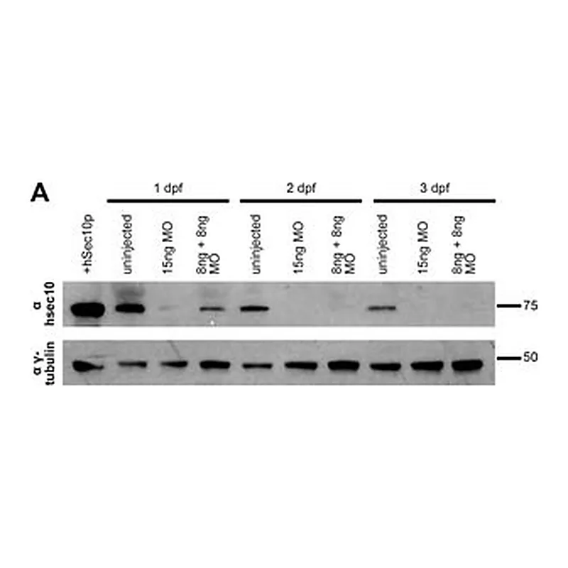 Merck ANTI-GAMMA TUBULIN, DEVELOPED IN RABBIT