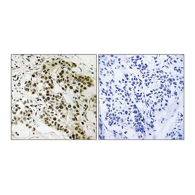 Merck Anti-Retinoblastoma antibody produced in rabbit