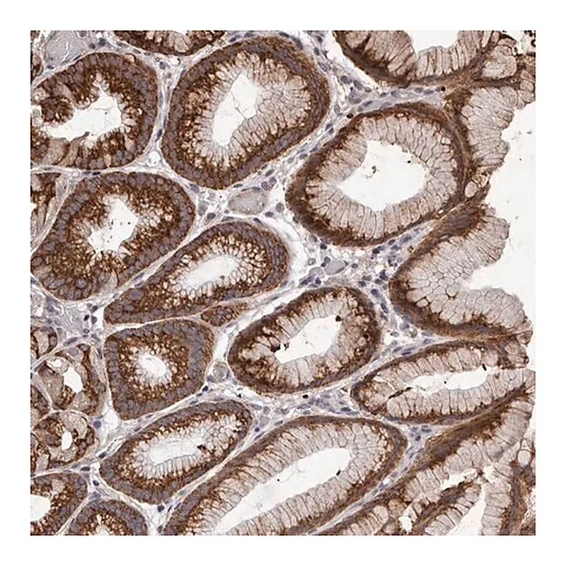 Merck Anti-NAV1 antibody produced in rabbit