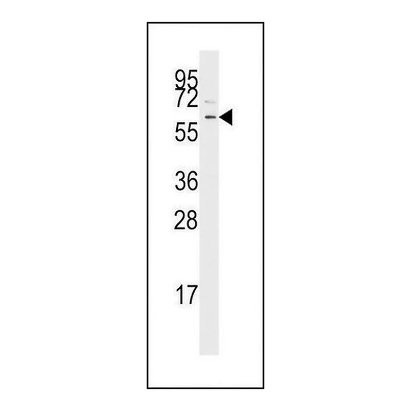 Merck ANTI-TGF BETA RECEPTOR I (CENTER) antibody produced in rabbit