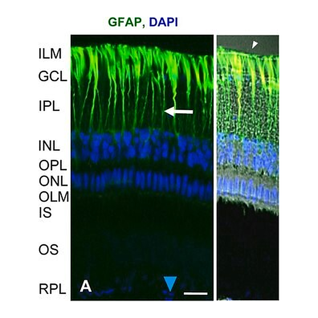 Merck ANTI-GLIAL FIBRILLARY ACIDIC PROTEIN&