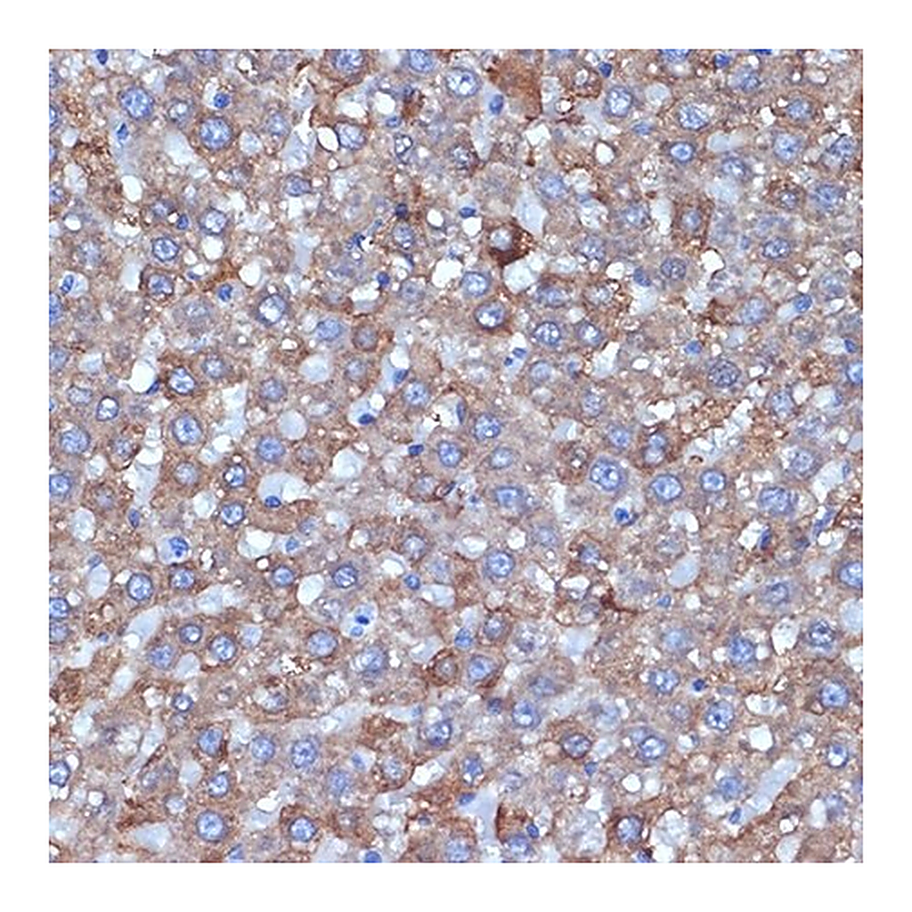 Merck Anti-ALDH1L1 antibody produced in rabbit