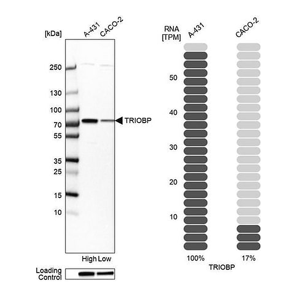 Merck Anti-TRIOBP antibody produced in rabbit
