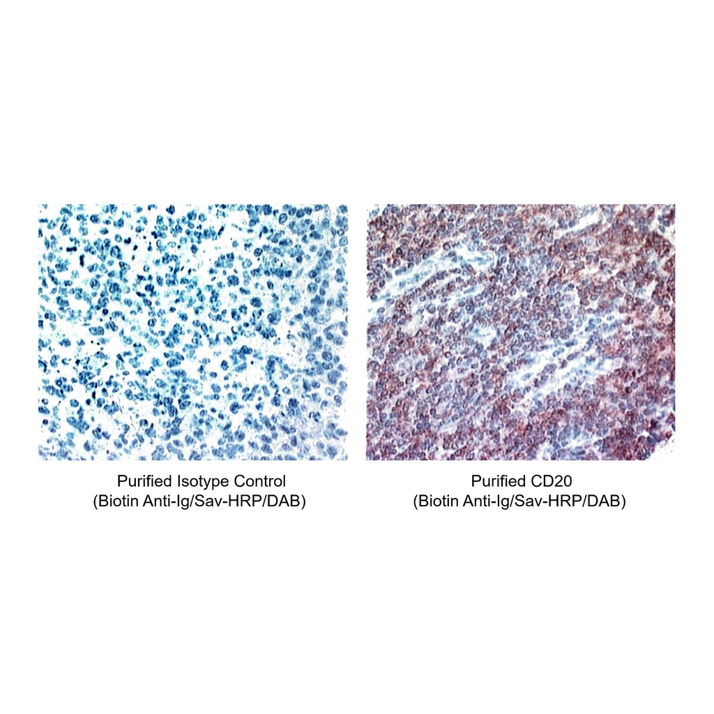 BD Purified Mouse Anti-Human CD20