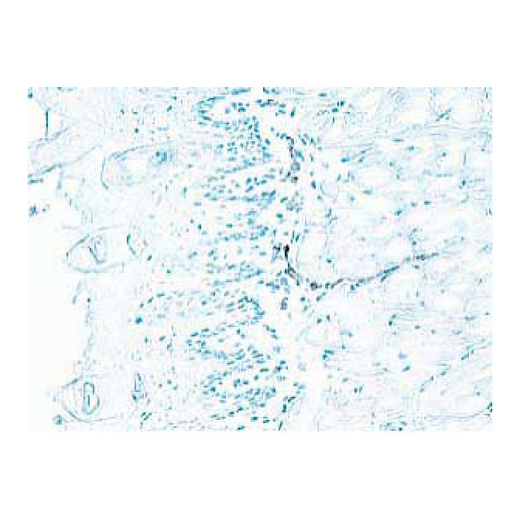 BD Purified Rat Anti-Mouse CD62E