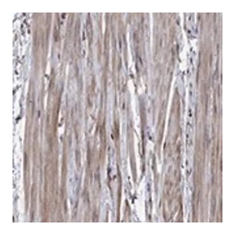 Merck Anti-GYG1 antibody produced in rabbit