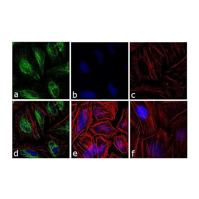 Thermo Fisher Scientific Donkey anti-Rabbit IgG (H+L) Cross-Adsorbed Secondary Antibody, DyLight 488