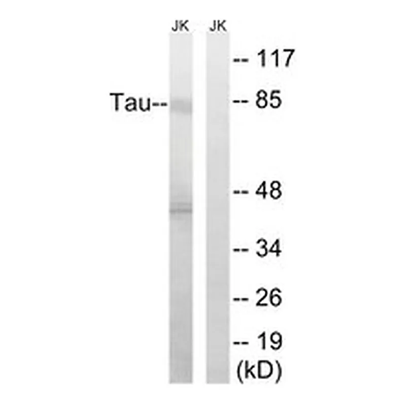 Merck ANTI-TAU