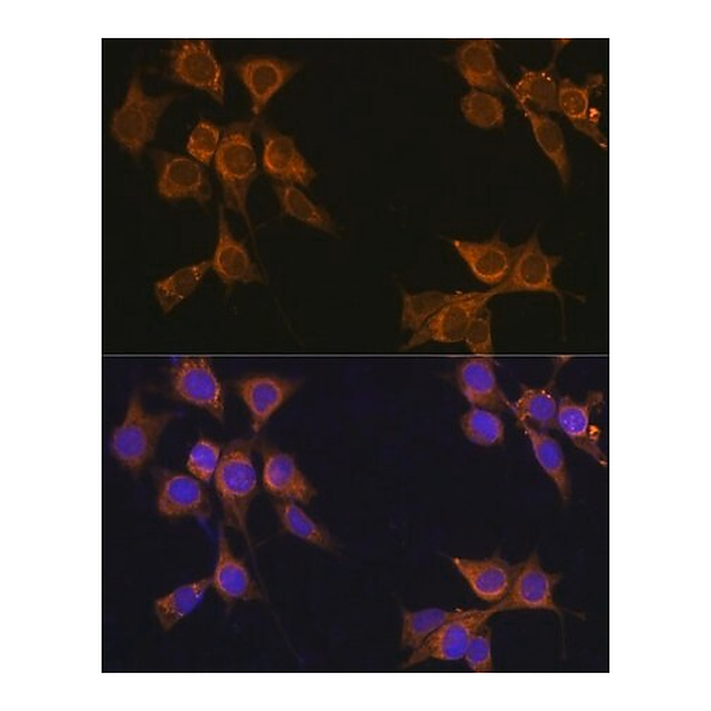 Merck Anti- CD133 antibody produced in rabbit
