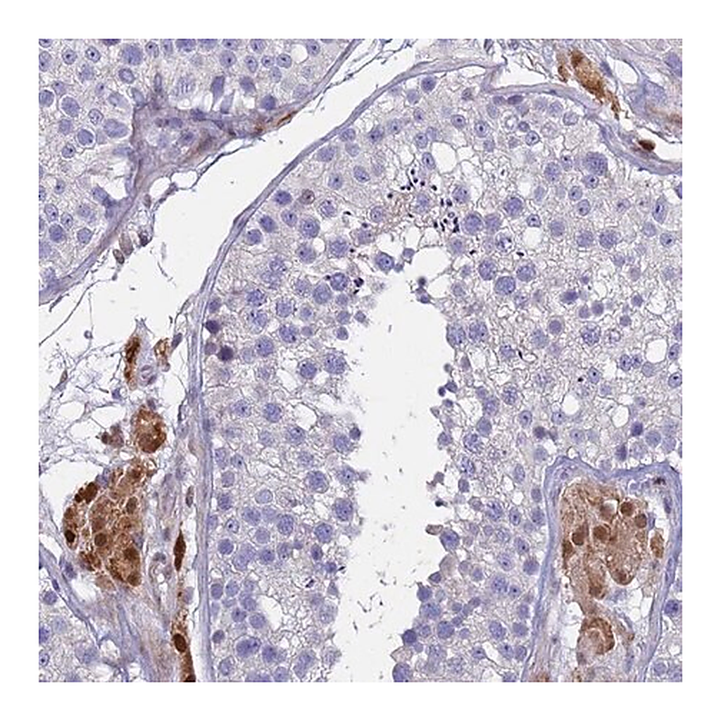 Merck Anti-PPP6R1 antibody produced in rabbit