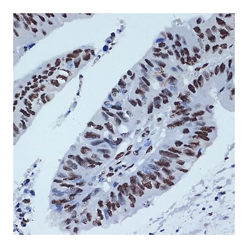 Merck Anti-ZBTB7A/FBI-1/LRF antibody produced in rabbit