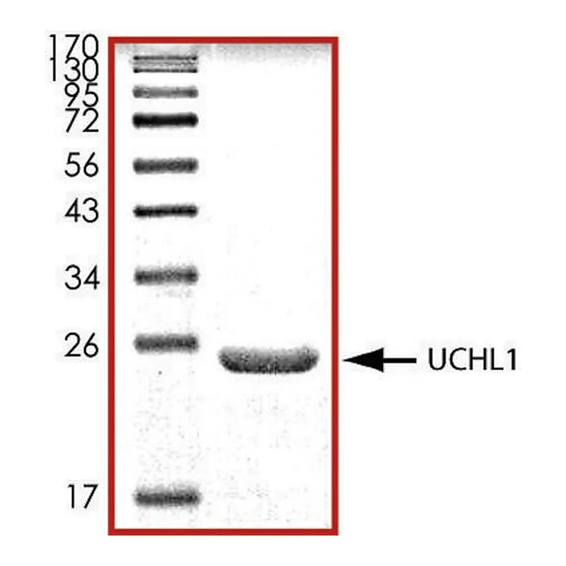 Merck UCHL1, His tagged human