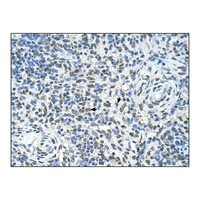 Merck Anti-ZMyND11 (AB1) antibody produced in rabbit