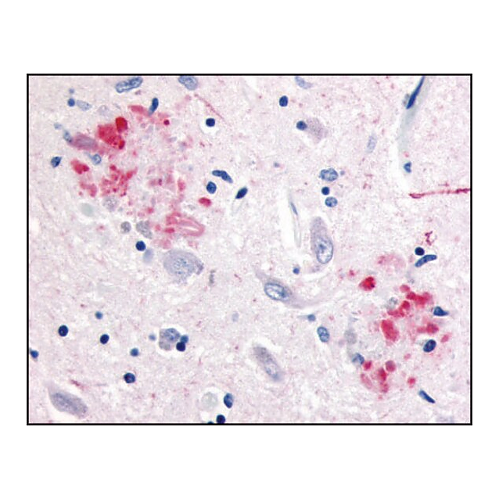 Merck Anti-APP antibody produced in rabbit