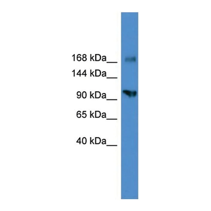 Merck ANTI-AXL (C-TERMINAL) ANTIBODY PRODUCED