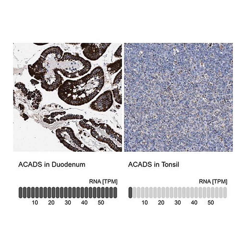 Merck Anti-ACADS antibody produced in rabbit