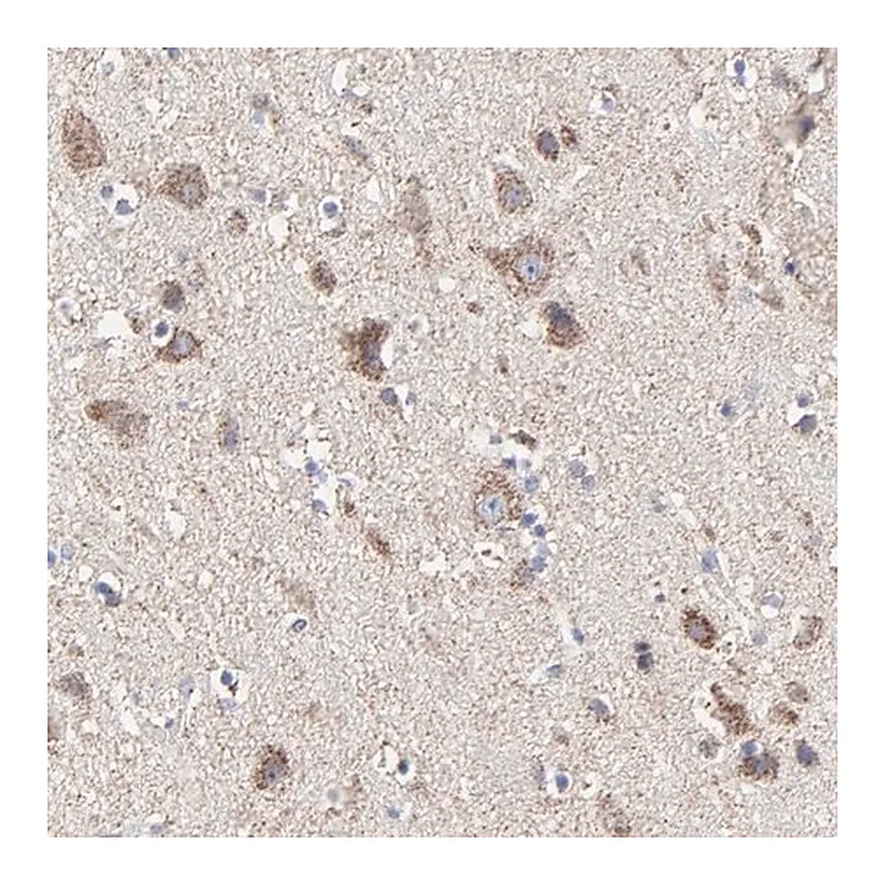 Merck Anti-PINK1 antibody produced in rabbit