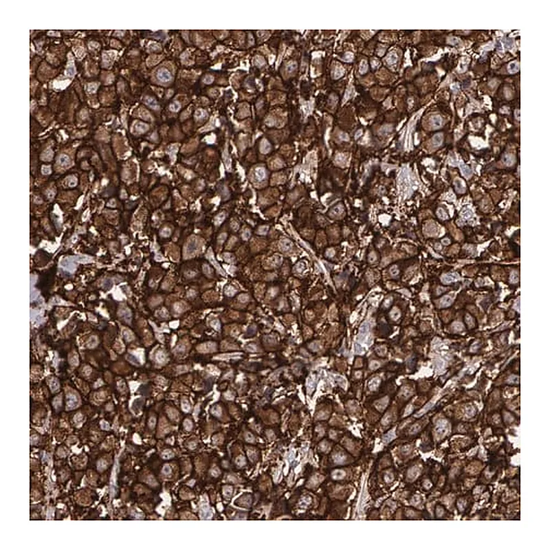 Merck Anti-ERBB2 antibody produced in rabbit