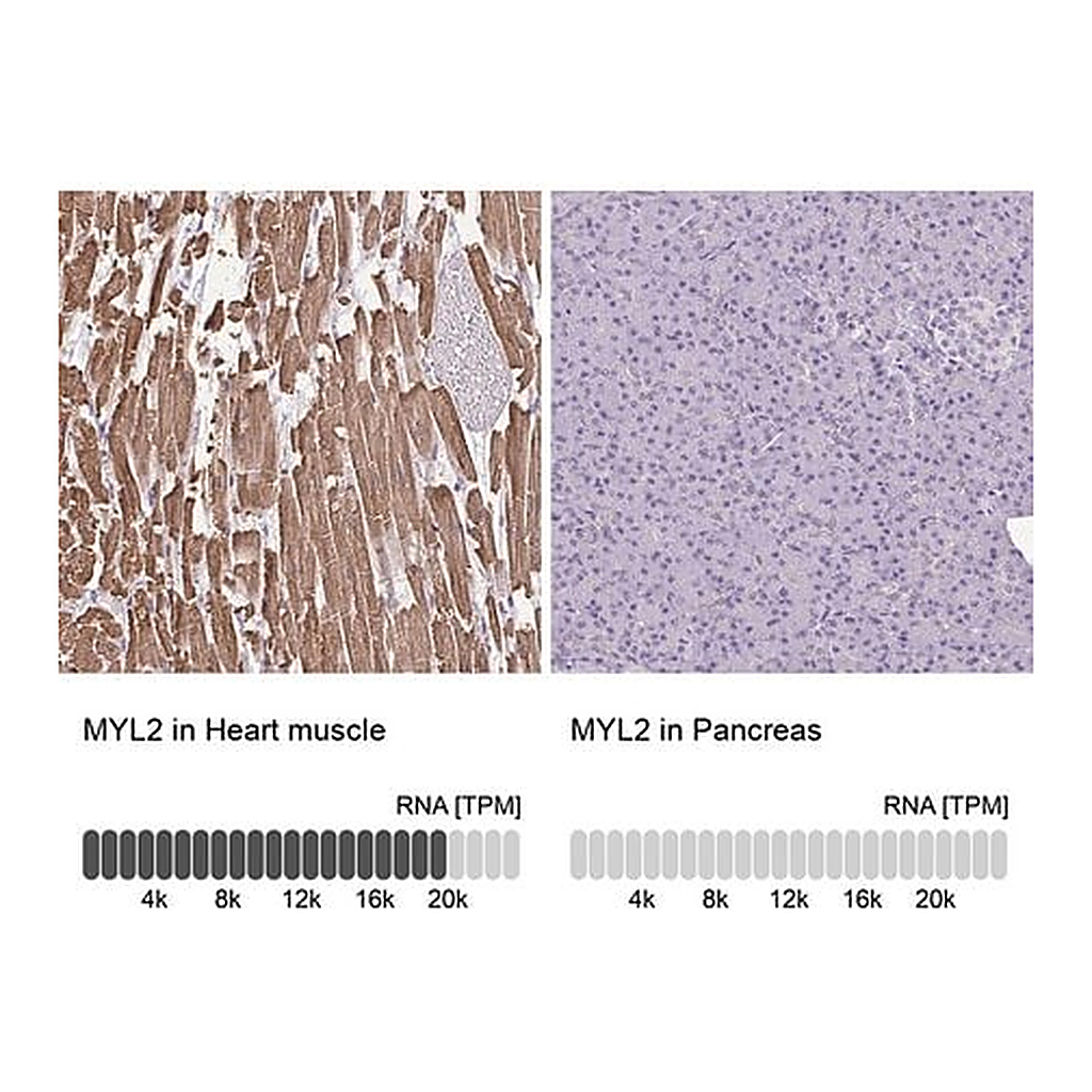 Merck Anti-MYL2 antibody produced in rabbit