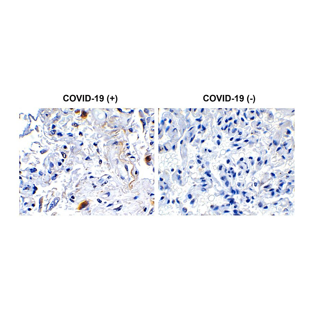 Merck Anti-SARS-CoV-2 (COVID-19) NSP2 antibody produced in rabbit