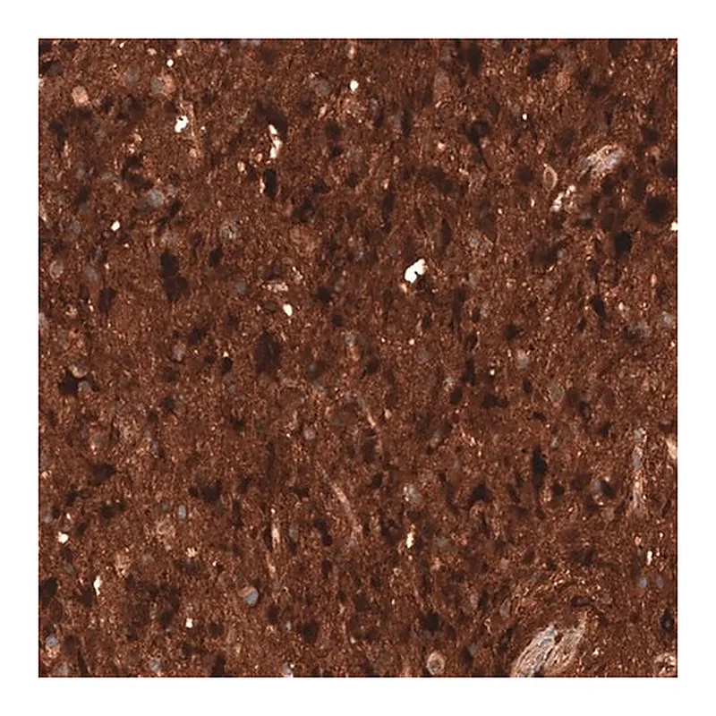 Merck Monoclonal Anti-CHI3L1 antibody produced in mouse