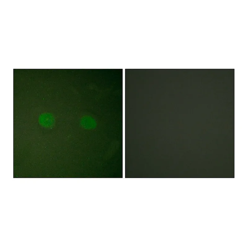 Merck Anti-PPAR-alpha antibody produced in rabbit