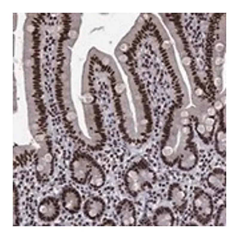 Merck Anti-RPRD1B antibody produced in rabbit