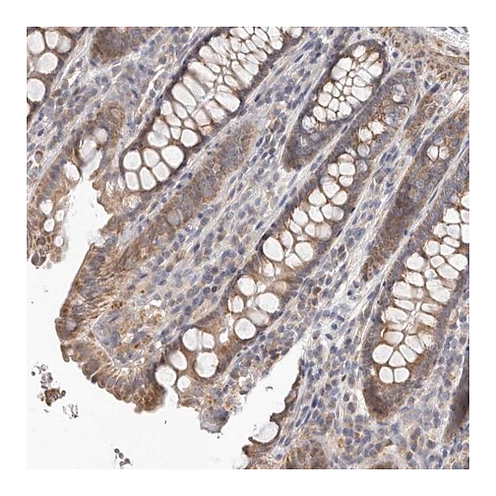 Merck Anti-UNK antibody produced in rabbit
