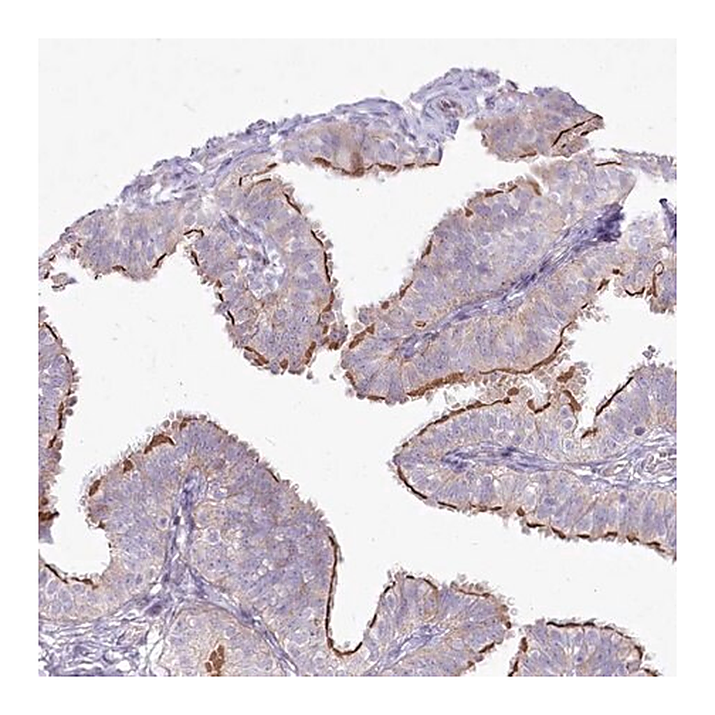 Merck Anti-CEP164 antibody produced in rabbit