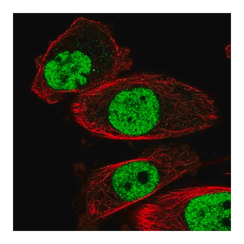 Merck Anti-HNRNPA2B1 antibody produced in rabbit