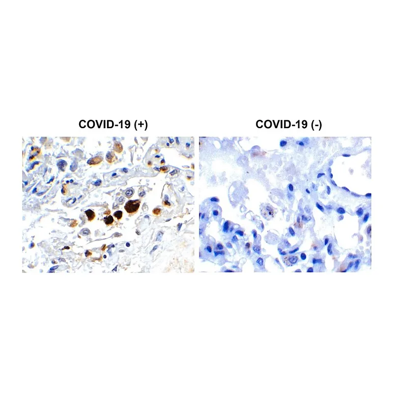 Merck Anti-SARS-CoV-2 (COVID-19) Membrane antibody produced in rabbit