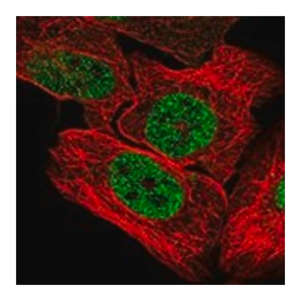 Merck Anti-UBN1 antibody produced in rabbit