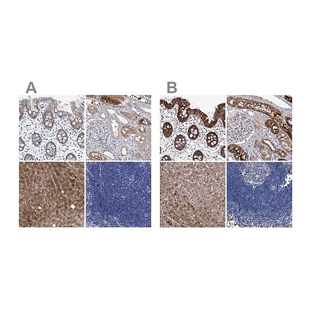 Merck Anti-GPT antibody produced in rabbit
