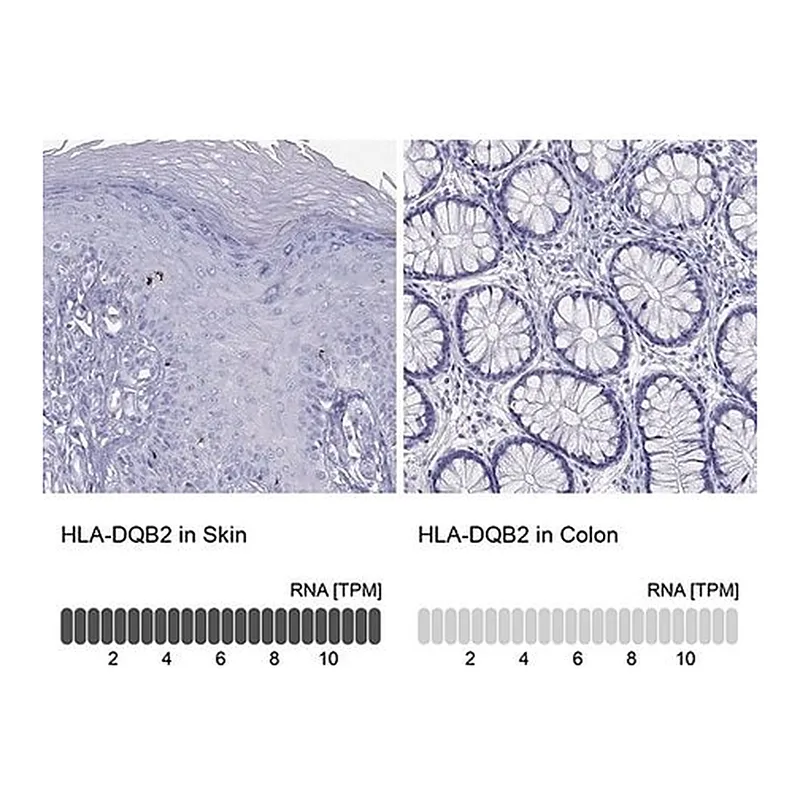 Merck Anti-HLA-DQB2 antibody produced in rabbit