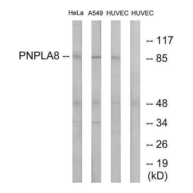 Merck Anti-PNPLA8 antibody produced in rabbit