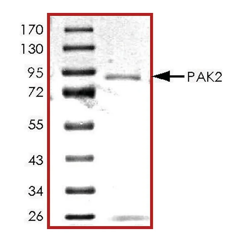 Merck PAK2, GST tagged human