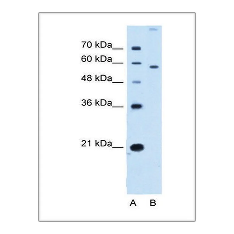 Merck Anti-SLC22A2