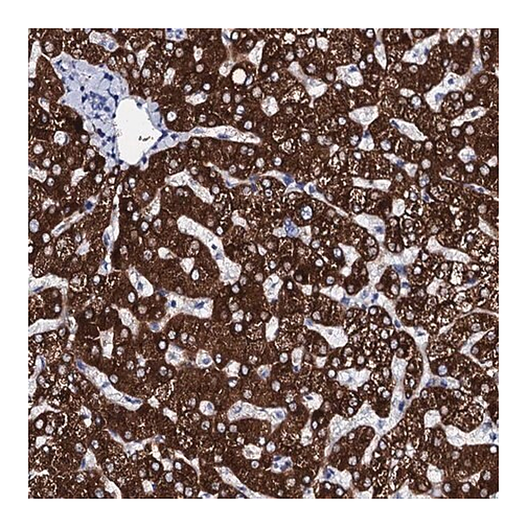 Merck Anti-GYS2 antibody produced in rabbit