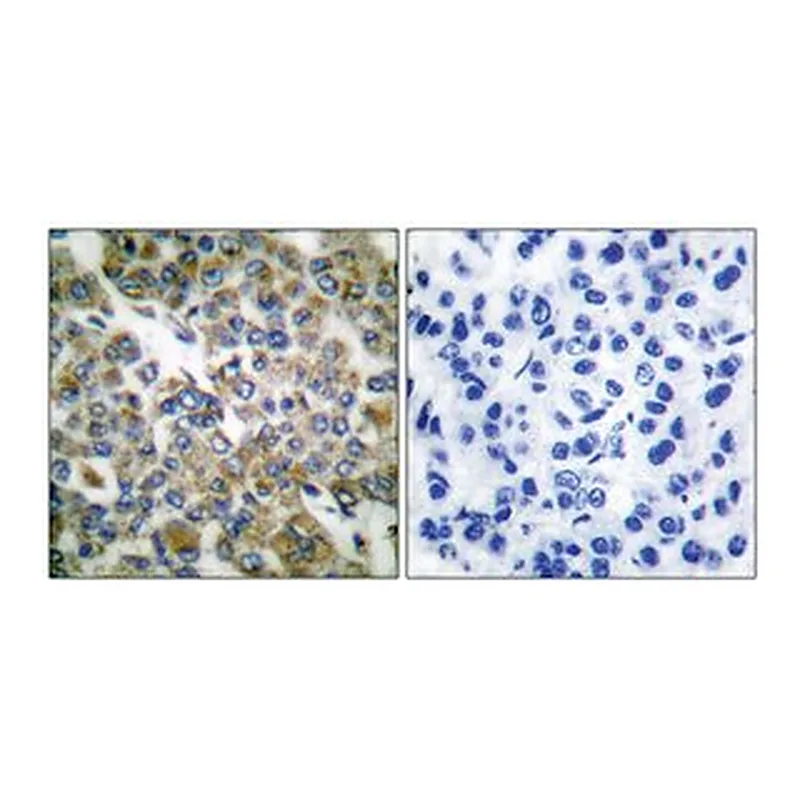 Merck ANTI-KERATIN 14 ANTIBODY PROD IN RAB