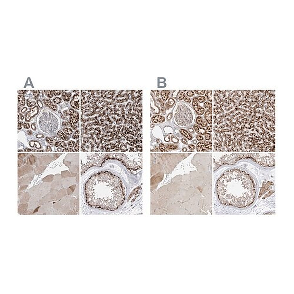 Merck Anti-ABCD3 antibody produced in rabbit