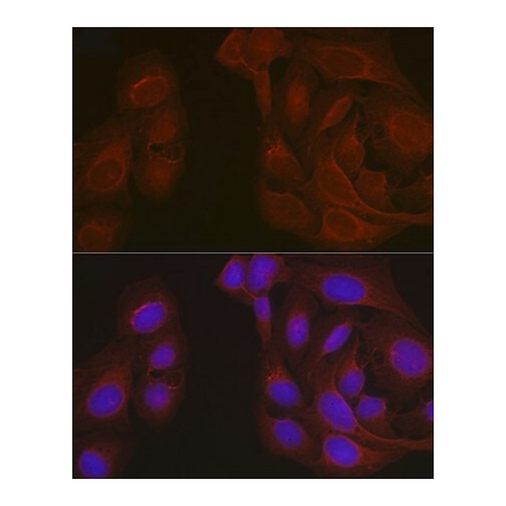 Merck Anti- Notch1 antibody produced in rabbit