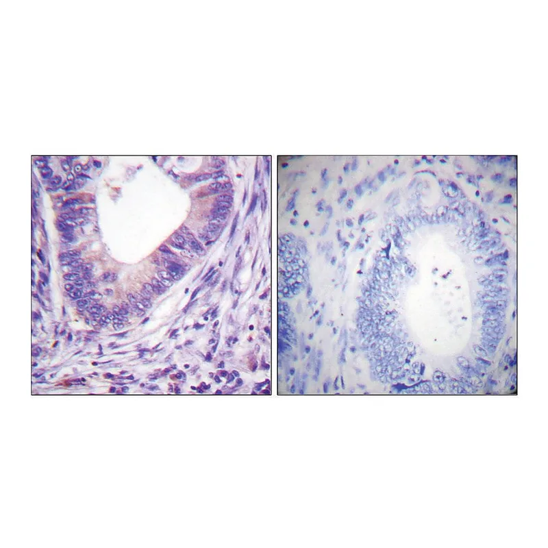 Merck Anti-PKA alpha antibody produced in rabbit