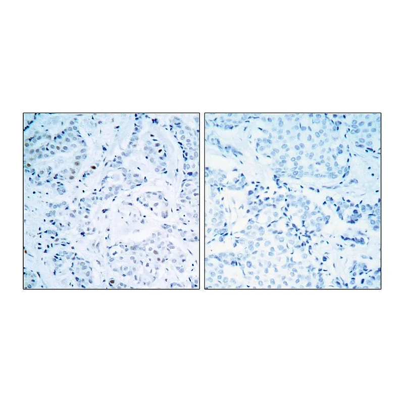 Merck Anti-Estrogen Receptor-alpha antibody produced in rabbit