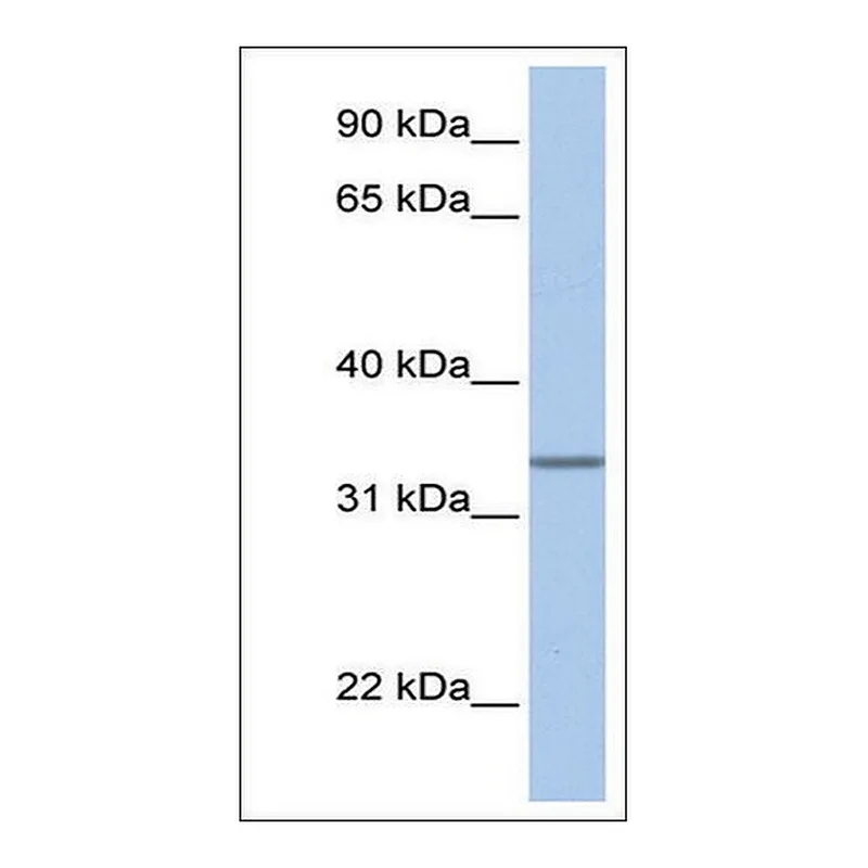 Merck Anti-SPDEF (AB1) antibody produced in rabbit