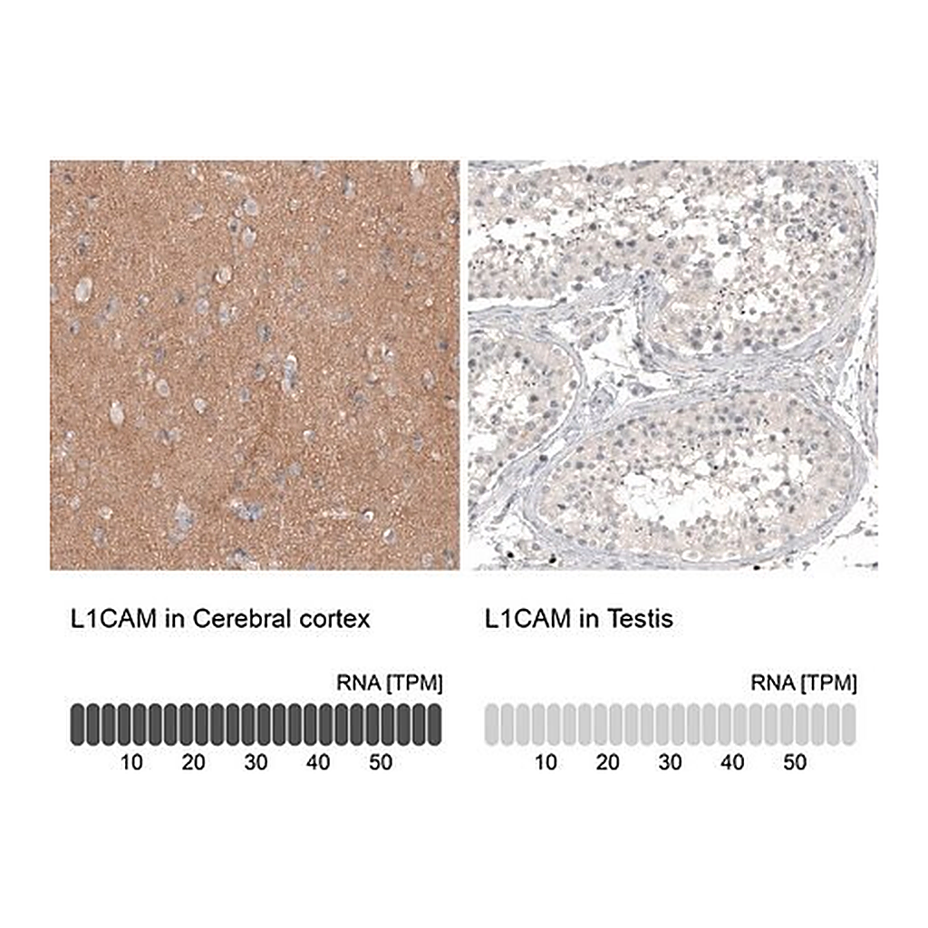Merck Anti-L1CAM antibody produced in mouse